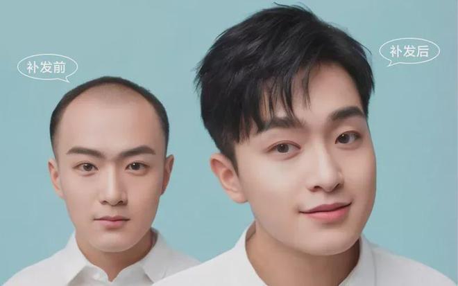 k8凯发娱乐揭秘假发店隐形陷阱！远离宰客雷区